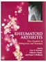 Rheumatoid Arthritis: Frontiers in Pathogenesis and Treatment
