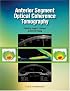 Anterior Segment Optical Coherence Tomography