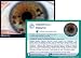 Search : Iridology Constitutional Signs flash cards