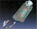 Bag Pump Kangaroo Sterile Enteral Feeding Pump Set And 1000ml Easy Cap Bag