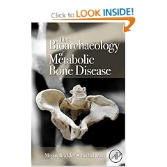 The Bioarchaeology of Metabolic Bone Disease