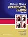 Mathog's Atlas of Craniofacial Trauma