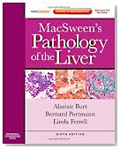 MacSween's Pathology of the Liver: Expert Consult: Online and Print, 6e (Expert Consult Title: Online + Print)