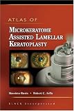 Atlas of Microkeratome Assisted Lamellar Keratoplasty