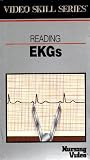 Reading Ekgs, Video Skill Series, Nursing Video