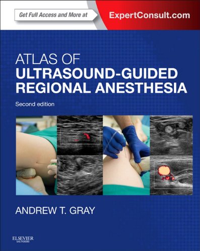 Atlas of Ultrasound-Guided Regional Anesthesia: Expert Consult - Online