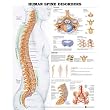 Anatomical Chart Company Human Spine Disorders Chart