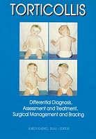 Torticollis : Differential Diagnosis, Assessment, and Treatment, Surgical Management and Bracing (for Pediatrics)