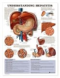Understanding Hepatitis Anatomical Chart Laminated (In Stock)-9992PL1.5