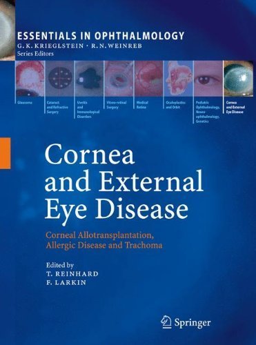 Cornea and External Eye Disease: Corneal Allotransplantation, Allergic Disease and Trachoma (Essentials in Ophthalmology) (2010-02-18)
