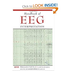 Handbook of Eeg Interpretation by William O. Tatum
