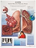 3B Scientific VR1329L Glossy Laminated Paper COPD Chronic Obstructive Pulmonary Disease Anatomical Chart, Poster Size 20" Width x 26" Height