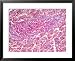 Anthrax, Bacillus Anthracis & Red Infected Cells in Animal Tissue Framed Art Poster P...