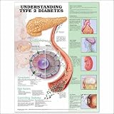 Understanding Type 2 Diabetes Anatomical Chart