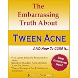 The Embarrassing Truth About Tween Acne AND How To Cure It