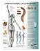 Understanding Osteoporosis Anatomical Chart Laminated, English (In Stock)-9881PL1.5