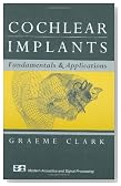 Cochlear Implants: Fundamentals and Applications (Modern Acoustics and Signal Processing)