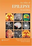 Atlas of Epilepsy, Second Edition (ENCYCLOPEDIA OF VISUAL MEDICINE SERIES)