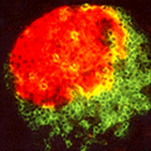 Digestive-Diseases