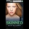 Skinned