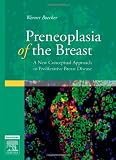 Preneoplasia of the Breast: A New Conceptual Approach to Proliferative Breast Disease, 1e