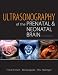 Ultrasonography of the Prenatal Brain, Third Edition