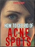 How To Get Rid Of Spots And Acne: What Are Spots & Acne And How Are They Caused?, Food Which Dont Help Spots, Calamansi, Home Remedies, Foods That Are Good For Spots and Acne Reviews 51nHECVSdNL. SL160 How To Get Rid Of Spots And Acne: What Are Spots & Acne And How Are They Caused?, Food Which Dont Help Spots, Calamansi, Home Remedies, Foods That Are Good For Spots and Acne Reviews