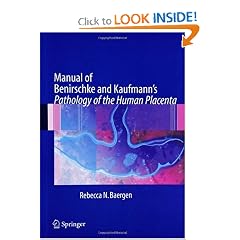 Manual of Benirschke and Kaufmann's Pathology of the Human Placenta by Rebecca N. Baergen