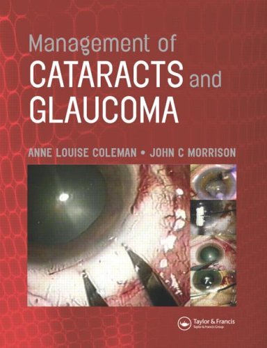 Management of Cataracts and Glaucoma