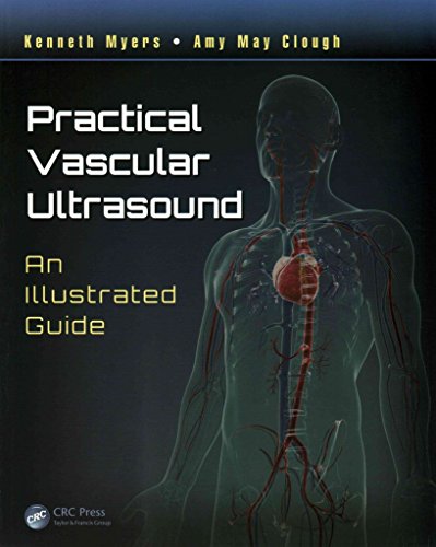 [Practical Vascular Ultrasound: An Illustrated Guide] (By: Kenneth Myers) [published: July, 2014]