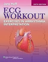 ECG Workout: Exercises in Arrhythmia Interpretation (Huff, ECG Workout) ECG Workout: Exercises in Arrhythmia Interpretation (Huff, ECG Workout)