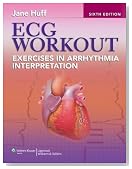 ECG Workout: Exercises in Arrhythmia Interpretation (Huff, ECG Workout)
