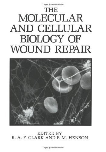The Molecular and Cellular Biology of Wound Repair 1988 edition by Clark, Richard, Henson, Peter (2013) Paperback