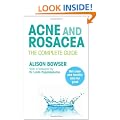 Acne and Rosacea: The Complete Guide