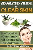 Advanced Guide to Clear Skin: How To Get Rid of Acne Naturally with Home Remedies That Actually Work