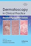 Dermatoscopy in clinical practice : beyond pigmented lesions