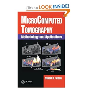 MicroComputed Tomography: Methodology and Applications by Stuart R. Stock
