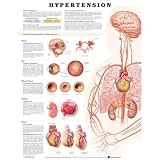 Hypertension Anatomical Chart