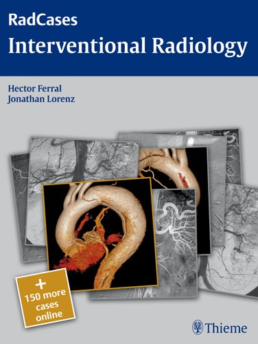 interventional radiology radcases