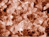 Lymph Nodules Node Sem Lymphocytes and Macrophages Photographic Poster Print, 16x12