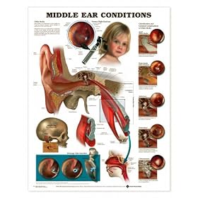 Middle Ear Conditions Anatomical Chart Laminated