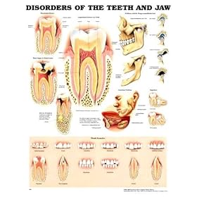 Chart - Disorders of the Teeth and Jaw