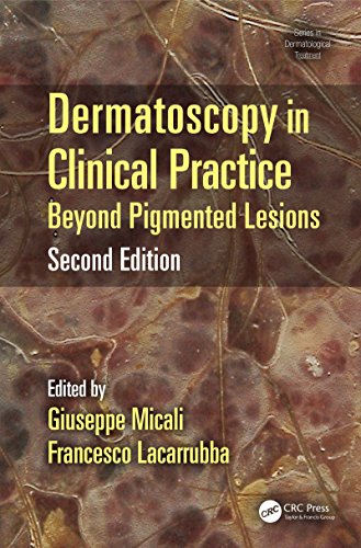 Dermatoscopy in Clinical Practice, Second Edition: Beyond Pigmented Lesions (Series in Dermatological Treatment)