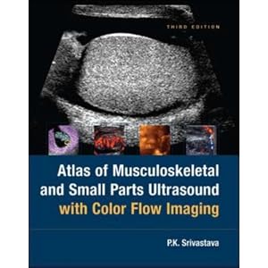 Atlas Of Musculoskeletal and Small Parts Ultrasound with Color Flow Imaging by PK Srivastava