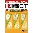 正常画像と並べてわかる新編頭部ＣＴ<br>百島 祐貴著 <br>羊土社<br>3045円<br>ISBN:9784758111720