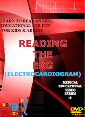 Advanced Cardiac Monitoring: Ventricular Ectopy vs. Aberrancy