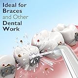 Dentalski Professional Water Flosser - Most Recommended by Dental Hygenist