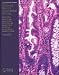 Books : Morson and Dawson's Gastrointestinal Pathology