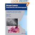 Casting Type Calcifications: Sign of a Subtype with Deceptive Features (Breast Cancer - Early... by Laszlo Tabar, Tibor Tot, and Peter Dean