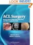 ACL Surgery: How To Get It Right the First Time and What To Do if it Fails (Bach, ACL Surgery)
